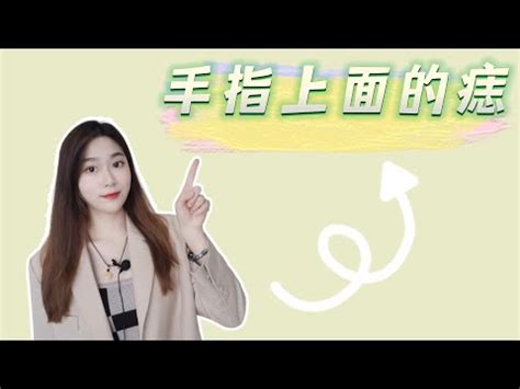 左手長痣|左手痣位置大不同,命運各異